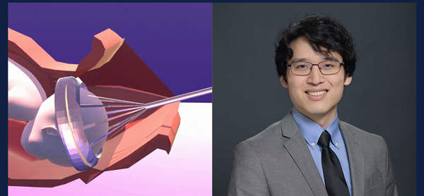 drawing of PeriAssist, which is designed to be a safer alternative to existing tools used in assisted vaginal delivery, beside portrait photo of its inventor, Anthony Wong
