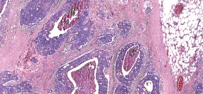 A ground-up approach to cancer research, staring with basic science and engineering, is the key to future clinical development — such as dye-free digital biopsies like this one, says Cancer Center at Illinois director Rohit Bhargava. Image courtesy of Rohit Bhargava