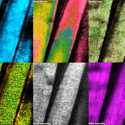 section of a mouse tail under the VAMPIRE microscope