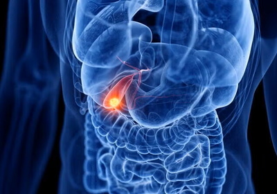 A 3D rendering of the internal organs with the gallbladder shown in red